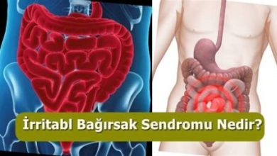 İrritabl Bağırsak Sendromu (IBS) Nedir?